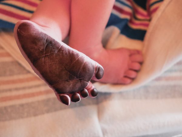 Underside of the foot of a baby showing black ink