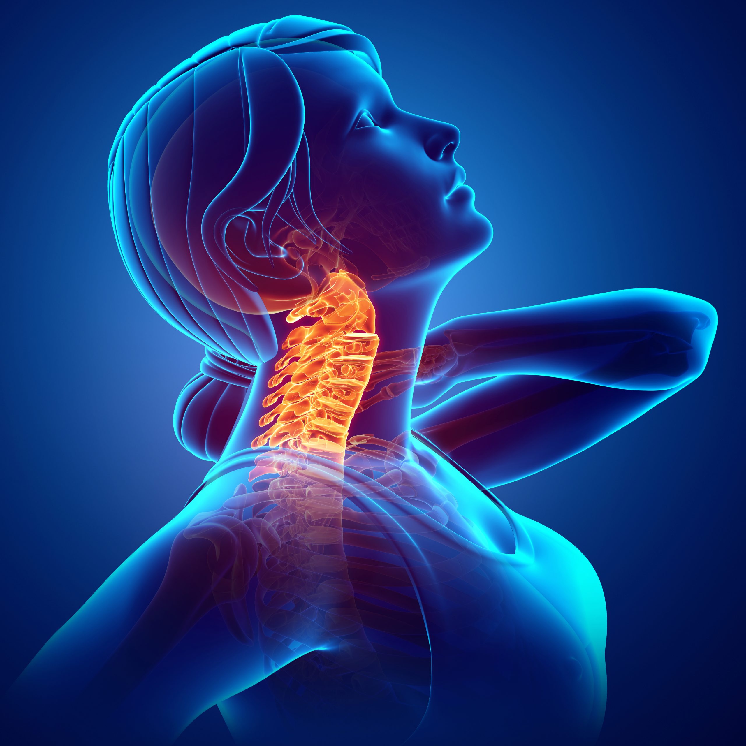 chronic neck pain illustration | Fairfield Medical Center